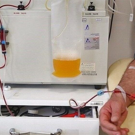 دستگاه پلاسمافِرزیس در خراسان شمالی/پایان اعزام بیماران و جهش در درمان بیماری‌های حاد خونی