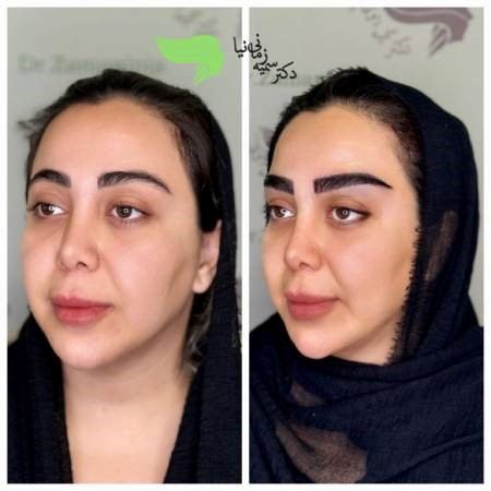 مدل های پرطرفدار کاشت ابرو مدل های پرطرفدار کاشت ابرو