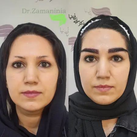 مدل های کاشت ابرو 2025 مدل های کاشت ابرو 2025