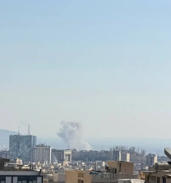 جزئیات مجروح شدن یک بازیگر در پی حمله آمریکا+ عکس