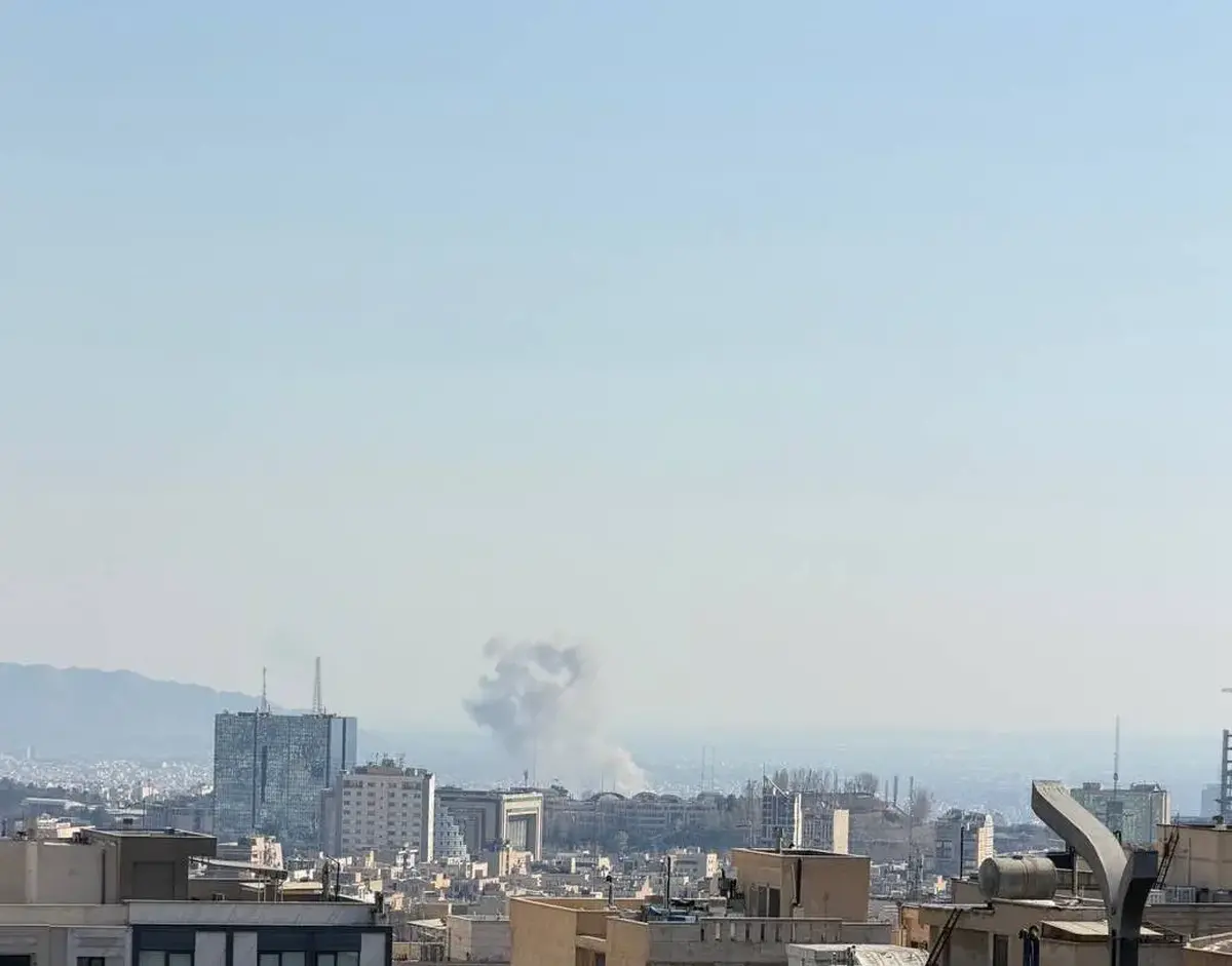 جزئیات مجروح شدن یک بازیگر در پی حمله آمریکا+ عکس