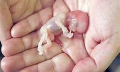 صدور کیفرخواست برای 9 متهم پرونده سقط جنین غیرقانونی در گلستان