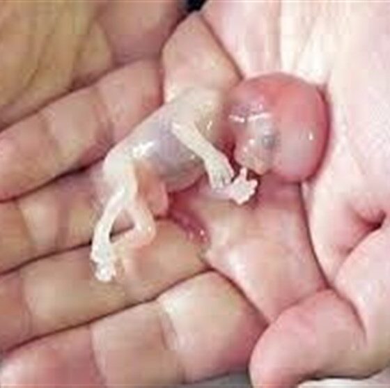 صدور کیفرخواست برای 9 متهم پرونده سقط جنین غیرقانونی در گلستان