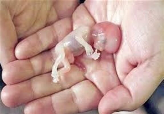 صدور کیفرخواست برای 9 متهم پرونده سقط جنین غیرقانونی در گلستان