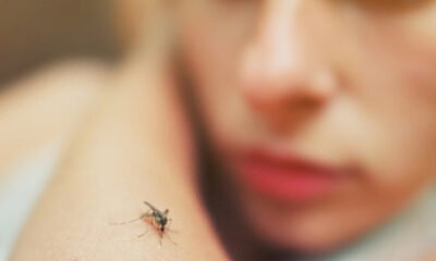 عفونت پوستی ناشی از نیش حشرات: علل ، علائم و درمان