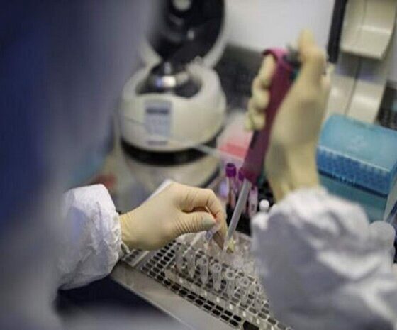 ناظمیان‌پور: ۳۷ هزار تست آزمایشگاهی در «دیر» انجام شد