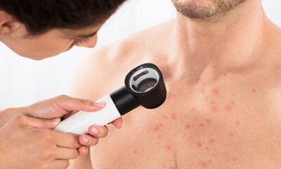 چرا گاهی پوست سینه پر از جوش می‌شود؟